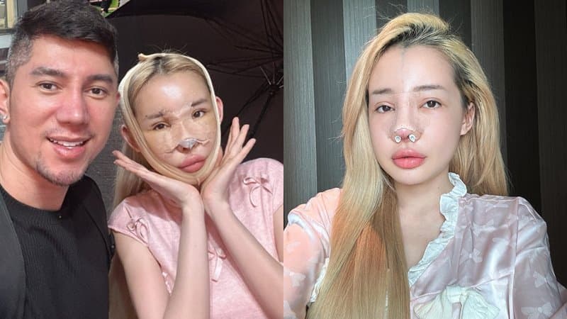 Ngân 98 đi sửa mũi lần thứ 10, diện mạo mới tiếp tục gây sốc