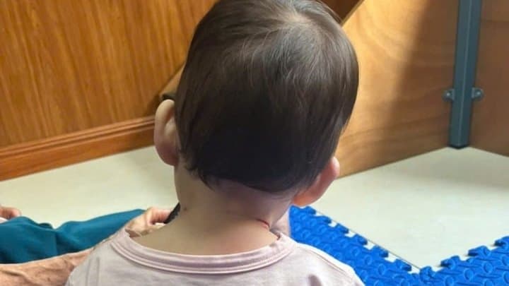 Sai lầm khiến trẻ bị vẹo cổ cha mẹ cần tránh
