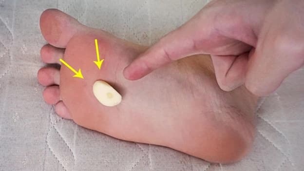 Chà tỏi lên lòng bàn chân, tưởng 'vô tri' nhưng mang lại cả tá lợi ích sức khỏe, làm đẹp