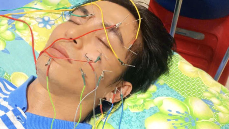 Nam diễn viên Lãnh Thanh bị liệt dây thần kinh số 7: Cảnh báo 3 thói quen gây bệnh mà giới trẻ thường mắc phải