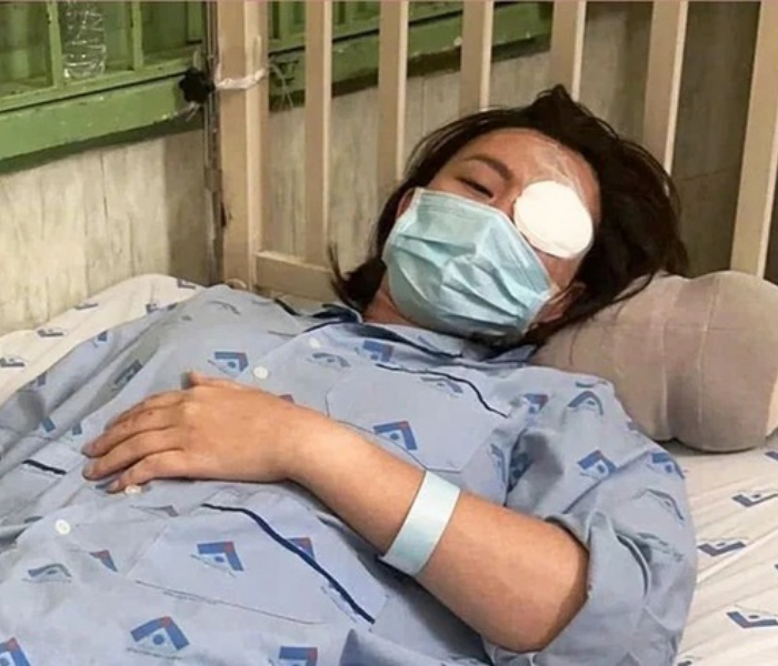 Cô gái bị người yêu cũ đánh gục trong quán cà phê, tổn thương 23% cơ thể: Yêu cầu bồi thường 900 triệu đồng