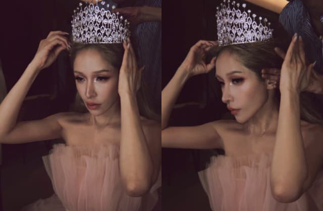Sốc nặng với 'gương mặt rắn' biến dạng của nữ ca sĩ hạng A sau vụ bị chó cắn đến hủy dung