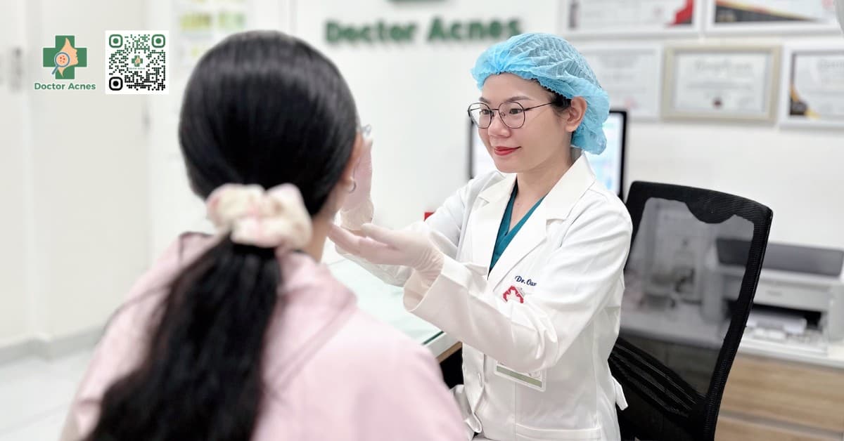 Top 10 loại kem trị mụn cho da dầu được đánh giá cao